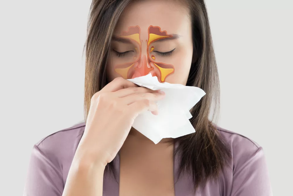 Seeking Medical Help for Sinus Infection