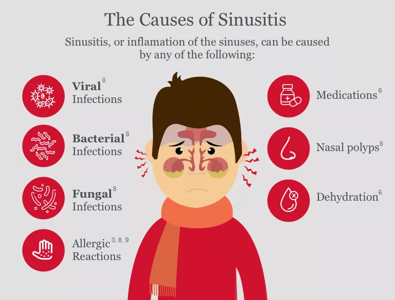 Causes of Sinus Infection