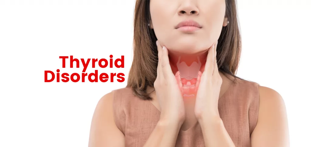 Demystifying Thyroid Disorders: Causes, Symptoms & Treatment