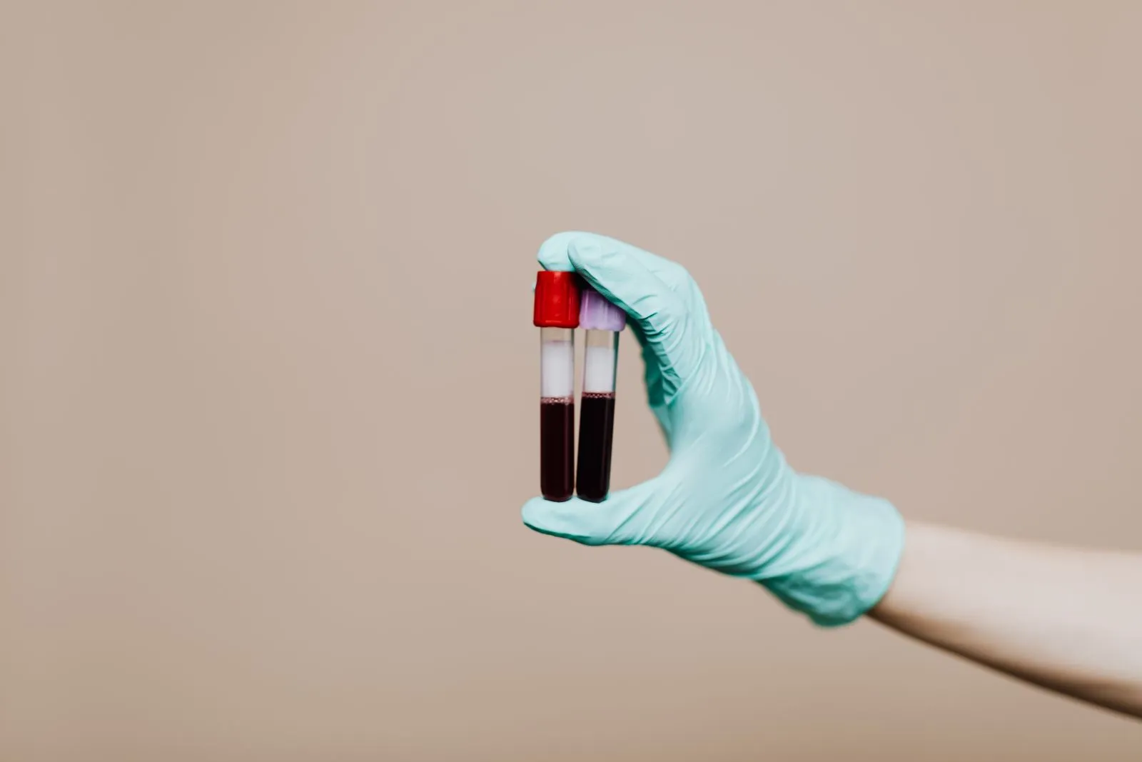 Gloved hand holding a blood sample tube for lab testing